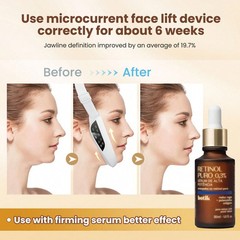 V Face Lifting Device, Electric Facial Massager for Slimming & Double Chin Re…
